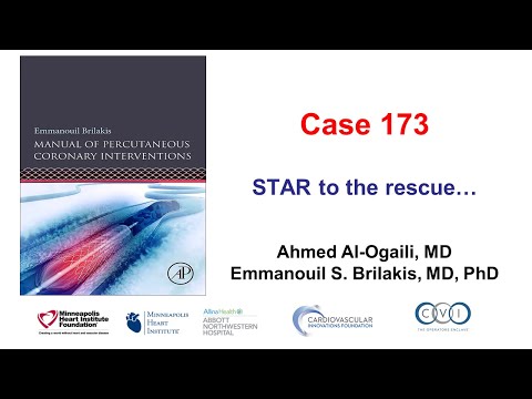 Case 173: Manual of PCI - STAR to the rescue