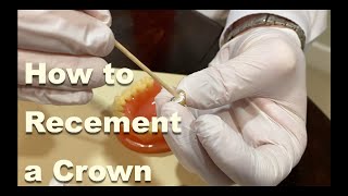 How to Recement a Crown (Temporarily) | 2 Minutes Tuesday with Dr. Guerre, DDS