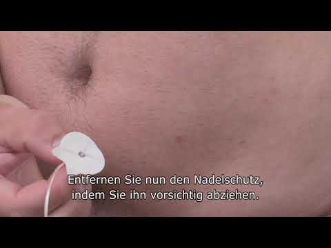 Einführen eines neuen TruSteel™ Infusionssets // t:slim X2™ Insulinpumpe