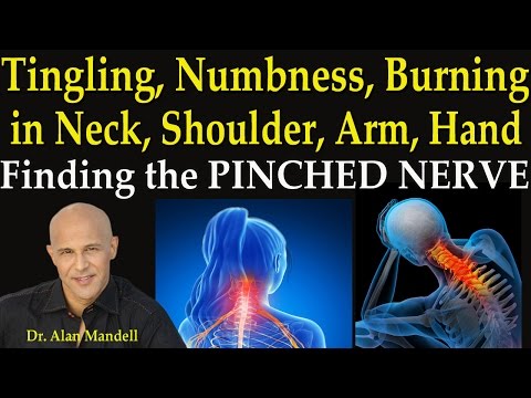 Tingling, Numbness, Burning in Neck, Shoulder, Arm, and Hand  -  Finding the PInched Nerve