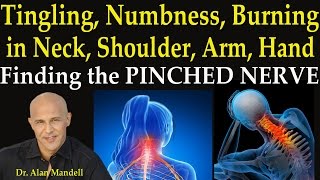 Tingling, Numbness, Burning in Neck, Shoulder, Arm, and Hand  -  Finding the PInched Nerve
