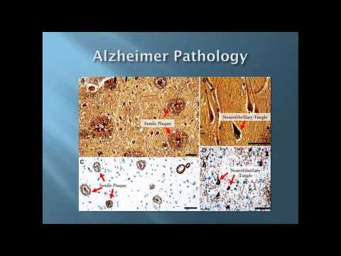 TEDxAlamo - George Perry -  Living with Aging: Alzheimer's, the Disease of Our Time