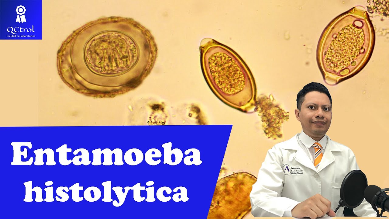 Meet Entamoeba histolytica: morphology and TIPS for its identification🔬