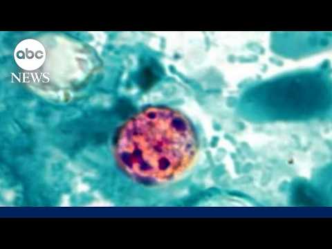 2 dead from cyclosporiasis in Michigan