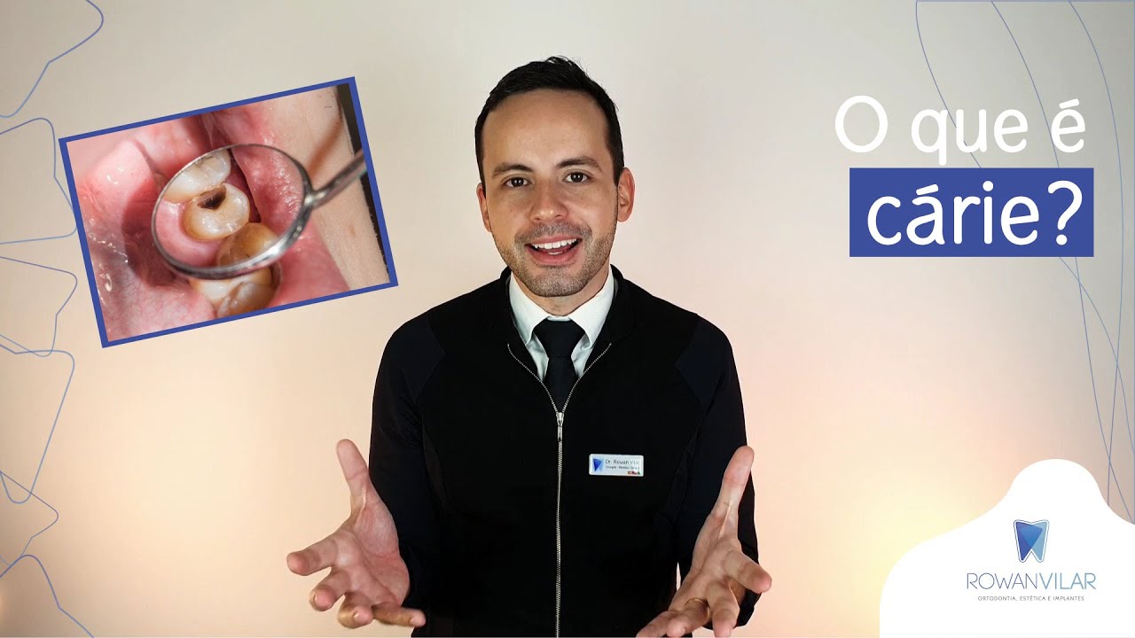 O que é cárie?