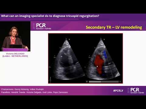 A team approach to the management of tricuspid regurgitation - PCR London Valves 2019