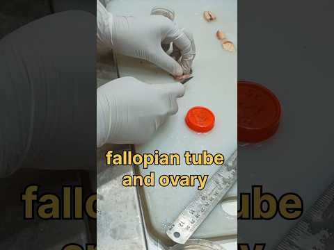 Fallopian tube and ovary tissue processing 🧐👀🤔🧐👀|#histopathology #fallopiantubes #ovary #ovariancyst
