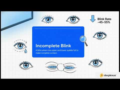 The Hidden Link Between Screens & Dry Eye