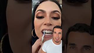 Se pintan los DIENTES con ESMALTE de UÑAS - Moda dental