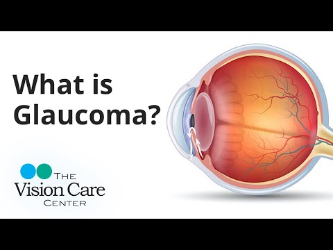 Dr. Weyer Explains: What is Glaucoma?