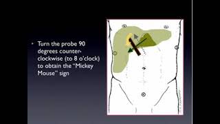 RUQ Ultrasound 512kb