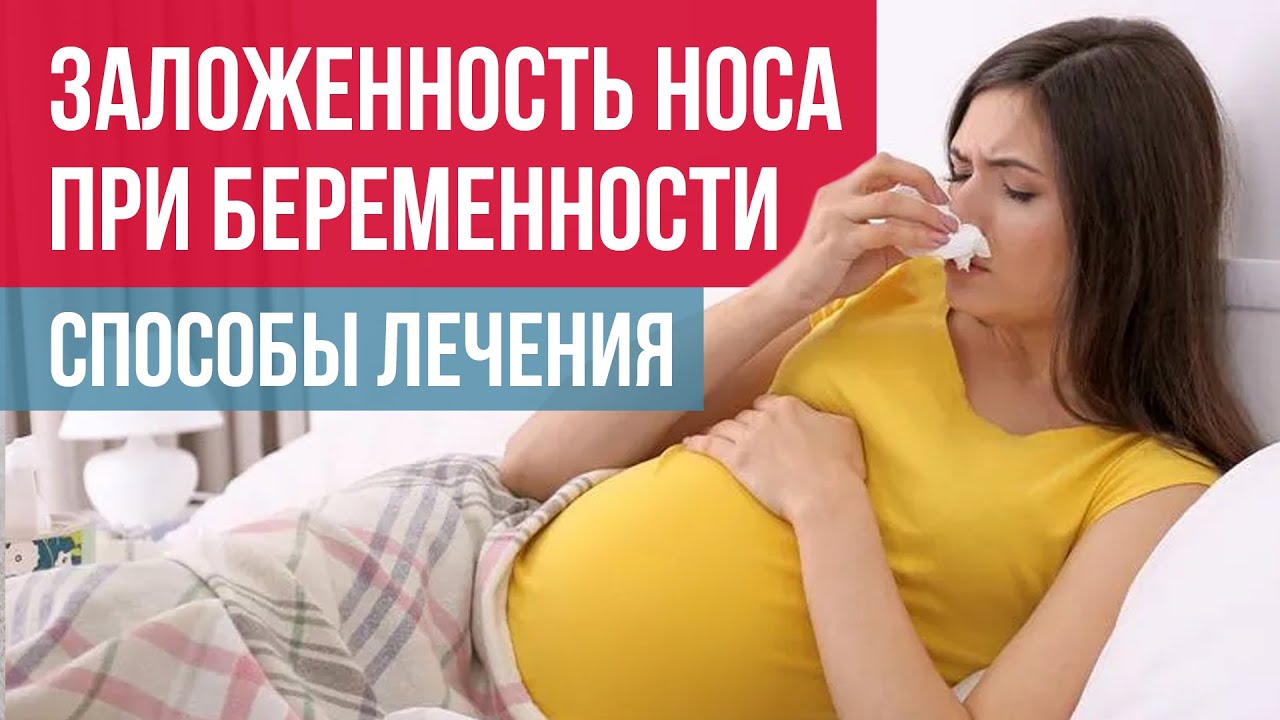 Заложенность носа при беременности: симптомы и лечение ринита беременных