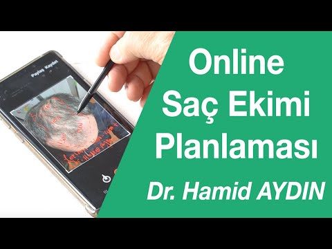 Saç Dökülmesi Hastalarının Fotoğraflarını Nasıl Planlıyorum? Uzaktan Online Saç Ekimi Muayenesi
