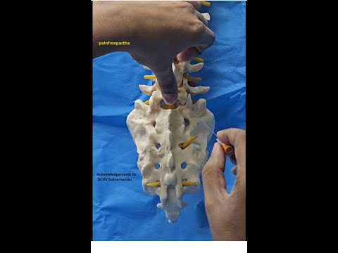 Video demonstration of taylor's approach of spinal anesthesia | Dr.S.Parthasarathy MD., DNB, PhD