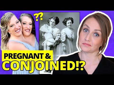 Can Conjoined Twins Give Birth?