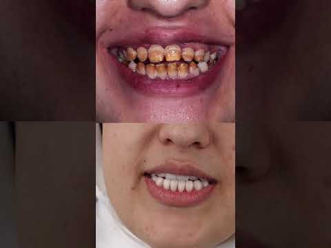 مهما كانت صعوبة حالتك حلها عندنا