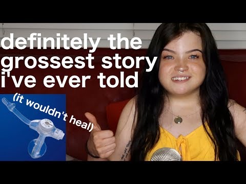 the time i lived with a hole in my stomach for over a month