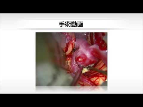 U-info｜実際の手術動画