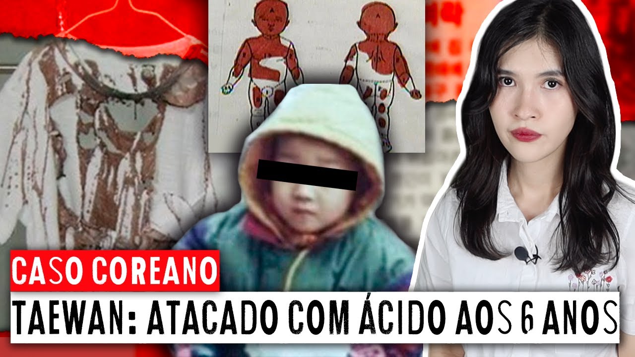 MENINO DE 6 ANOS sofre ATAQUE COM ÁCIDO na Coreia do Sul | Caso KIM TAEWAN