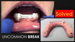 Solution for an Uncommon Break in a Full-Mouth Implant