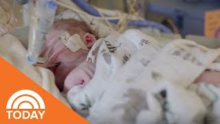 When A Child Has Congenital Heart Disease | TODAY
