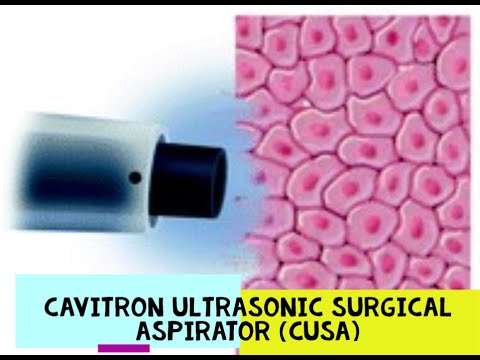 CAVITRON ULTRASONIC SURGICAL ASPIRATOR - CUSA
