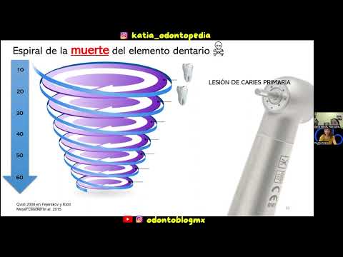 Espiral de la muerte del diente 🦷