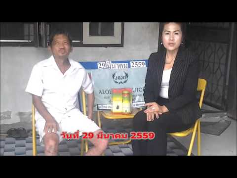 การรักษา HLS กลากในมือ โรคสะเก็ดเงินธรรมดา