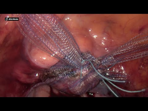 Порно куннилингус скрипт алтын душ шығару