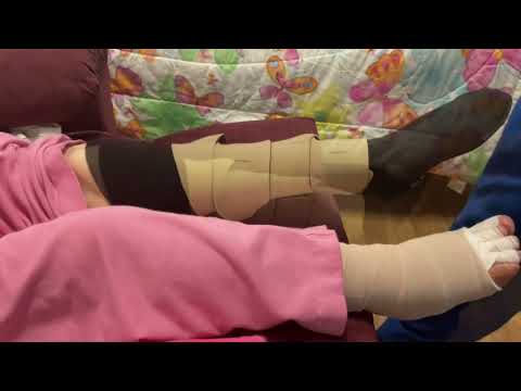 Effective Therapist Demonstration of Putting on Circaid Juxtalite Compression Garment for Caregivers