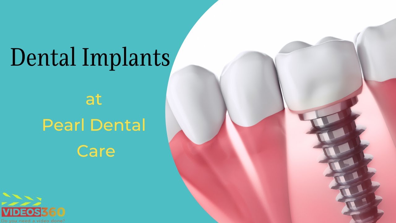 Dental Implants at Pearl Dental Care