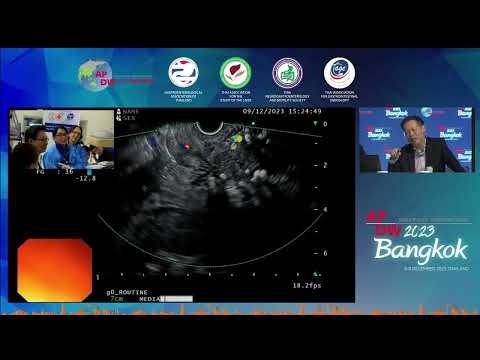 APDW 2023 live: EUS-guided FNB (Dr Yasuda, Dr Binmoeller)