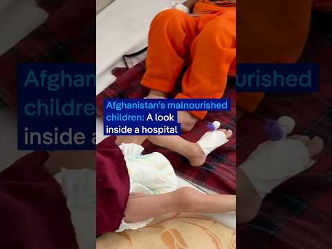 Afghanistan's malnourished children: A look inside a hospital | DW News