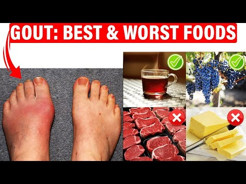 , title : '🔥Best Gout Diet & Foods To Avoid🔥 [URIC ACID Foods that Cause Gout!]'
