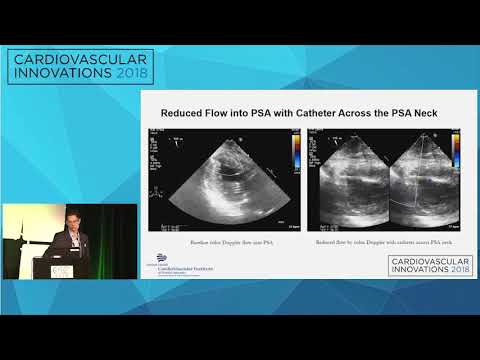 CVI2018 Session: Pseudoaneurysm therapy - Michael Kim, MD