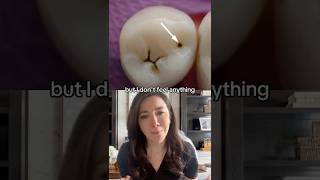 I Have A Tooth Cavity But I Don’t Feel Anything!