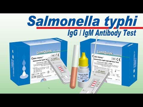 Salmonella typhi igg igm test