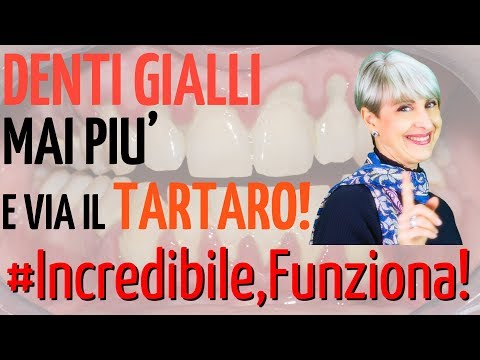 Le creme da pigmentary notano su risposte di faccia Faccia acquisti una lentiggine in Iskitim