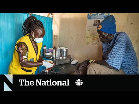 Canada looks to refugee camps for health-care workers