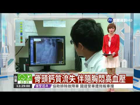 原發性副甲狀腺亢進 恐釀骨鬆