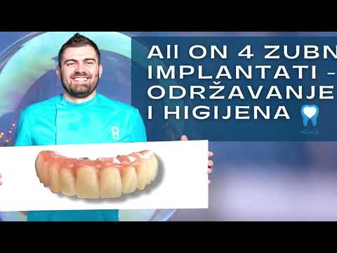 ALL ON 4 ZUBNI IMPLANTATI - Održavanje i higijena - Dental Centar 4Smile
