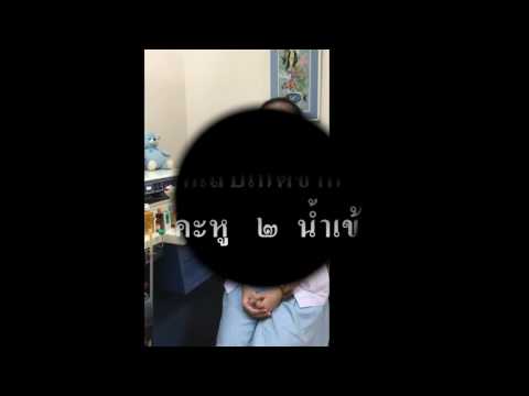 โรคผิวหนังโรคภูมิแพ้ภูมิแพ้ ไม่ว่าจะเป็นโรคสะเก็ดเงินเช่นทิ่ม