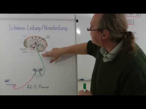 Schmerz, als durch verursacht werden Gequetschten Nerven der Halswirbelsäule