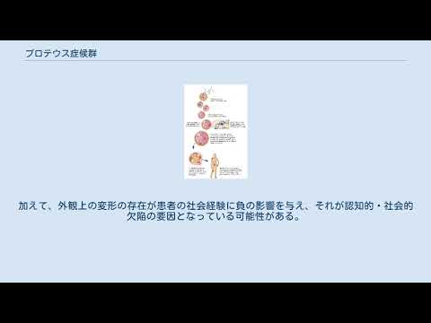 プロテウス症候群