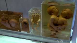 Medical Museum : anatomical collections of bones : preserved human organs