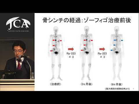 栄養学科 講演3「セラノスティクス～新時代の放射線治療～」渡部 直史（大阪大学大学院医学系研究科 放射線統合医学講座 核医学 助教）