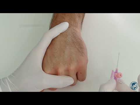 Tipps & Tricks beim Legen eines peripheren Venenkatheters (PVK)