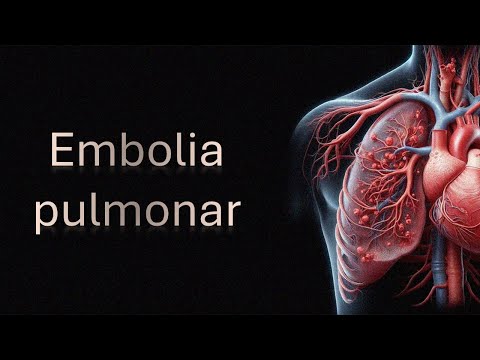 Pulmonary embolism