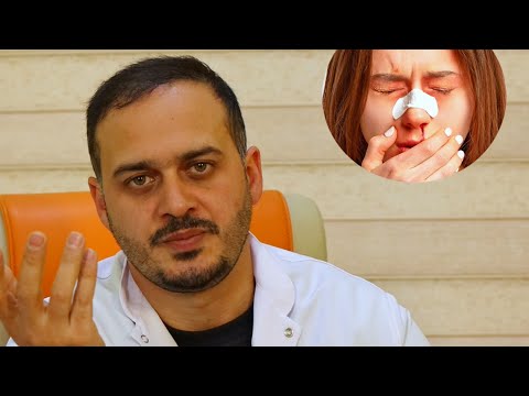 Nıyə rinoplastikadan sonra gips silikon istifadə etmirik ?