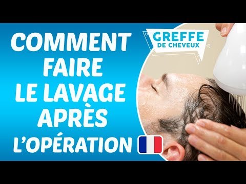 Le premier lavage après l'opération de greffe de cheveux
